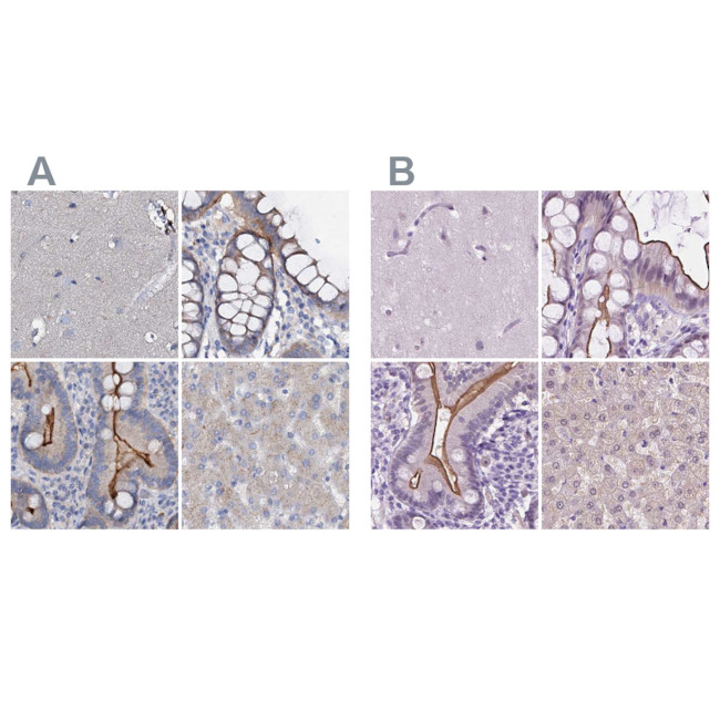 ACY3 Antibody in Immunohistochemistry (IHC)