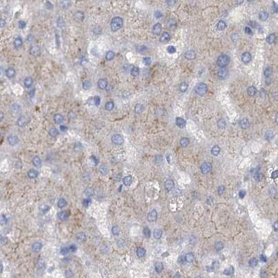 ACY3 Antibody in Immunohistochemistry (IHC)