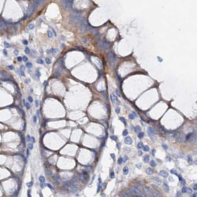 ACY3 Antibody in Immunohistochemistry (IHC)