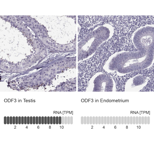 ODF3 Antibody in Immunohistochemistry (IHC)