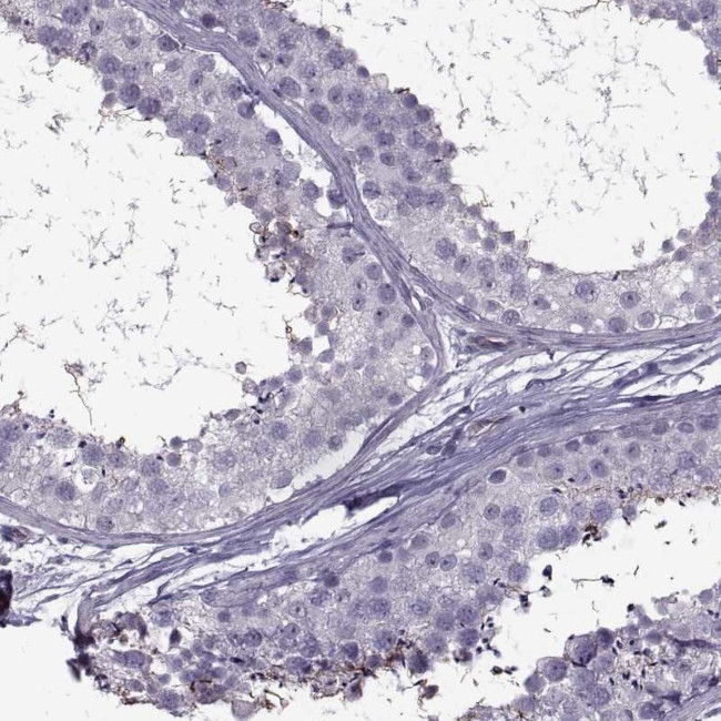 ODF3 Antibody in Immunohistochemistry (IHC)