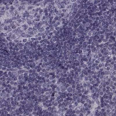 ODF3 Antibody in Immunohistochemistry (IHC)