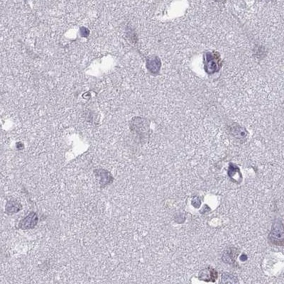 ODF3 Antibody in Immunohistochemistry (IHC)