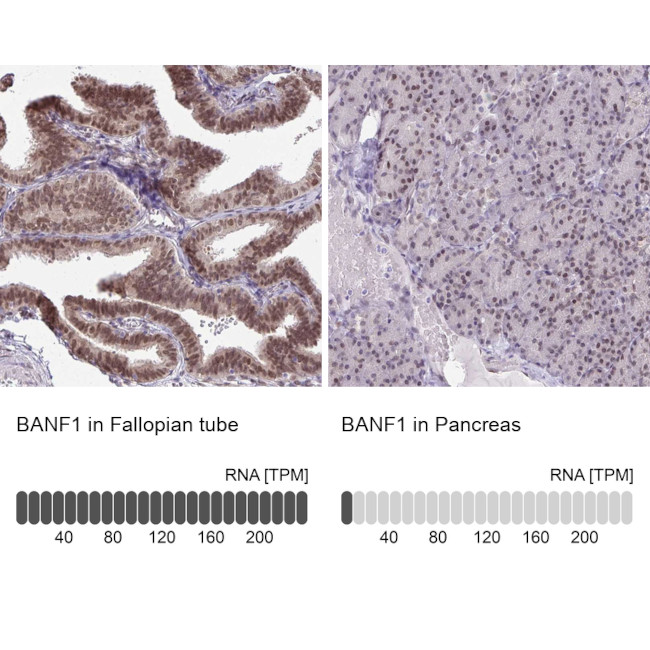 BANF1 Antibody in Immunohistochemistry (IHC)