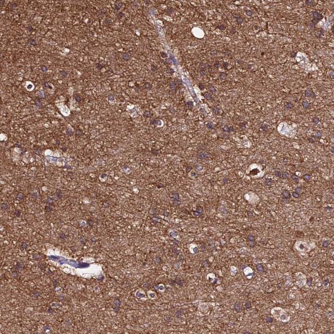 TUBA1A Antibody in Immunohistochemistry (IHC)