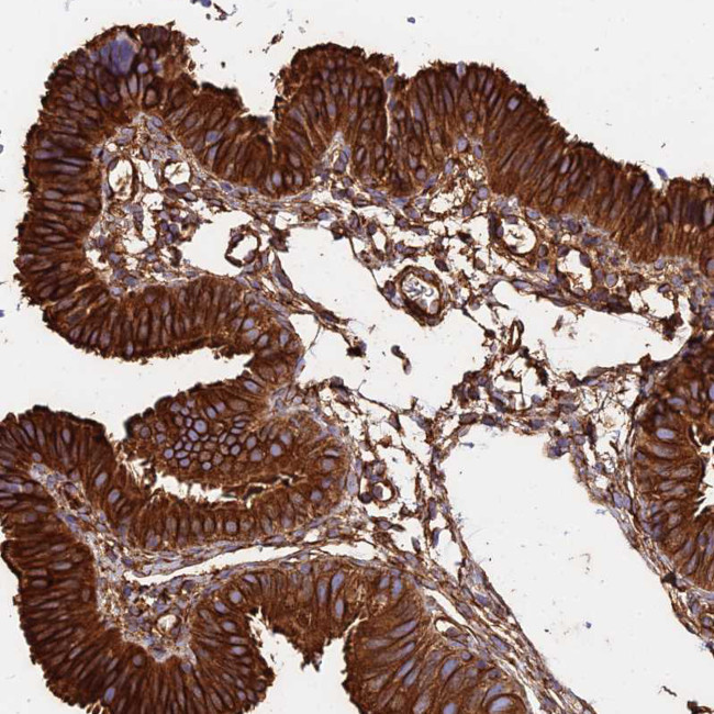 TUBA1A Antibody in Immunohistochemistry (IHC)