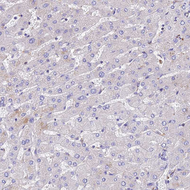 TUBA1A Antibody in Immunohistochemistry (IHC)