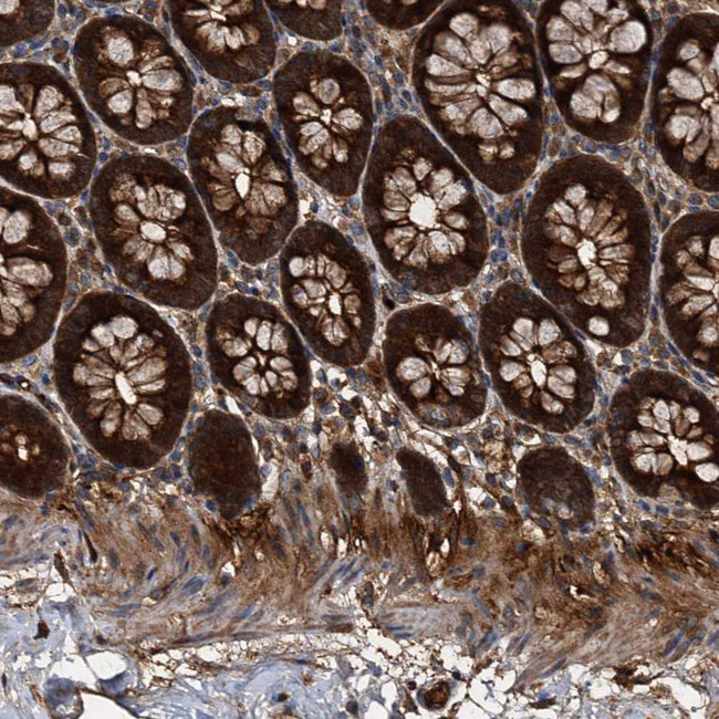 PEX5 Antibody in Immunohistochemistry (IHC)