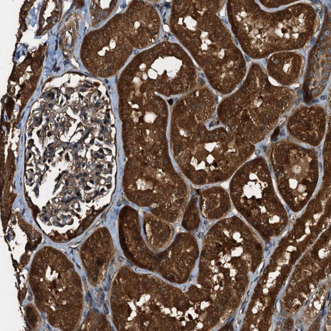 PEX5 Antibody in Immunohistochemistry (IHC)