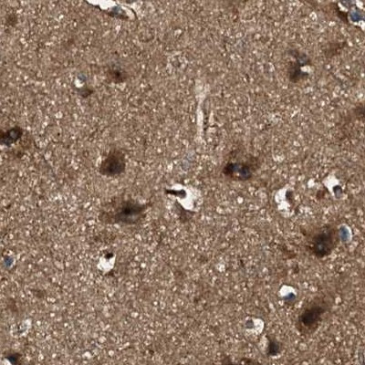 PEX5 Antibody in Immunohistochemistry (IHC)