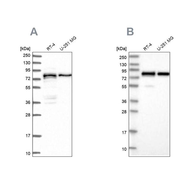 PEX5 Antibody in Western Blot (WB)