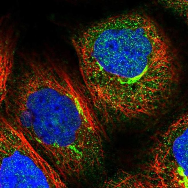 PEX5 Antibody in Immunocytochemistry (ICC/IF)