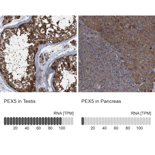 PEX5 Antibody in Immunohistochemistry (IHC)