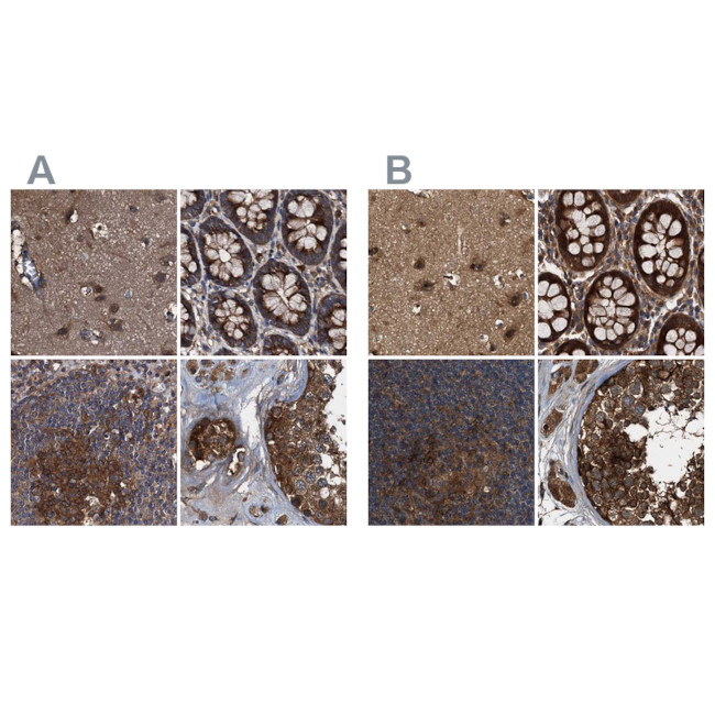 PEX5 Antibody in Immunohistochemistry (IHC)