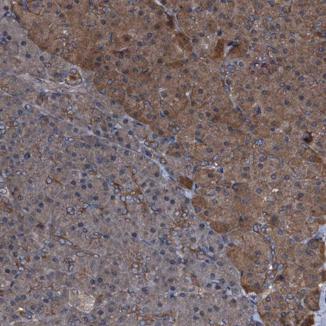 PEX5 Antibody in Immunohistochemistry (IHC)