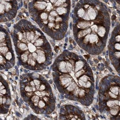 PEX5 Antibody in Immunohistochemistry (IHC)