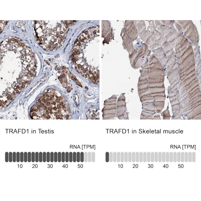 TRAFD1 Antibody in Immunohistochemistry (IHC)