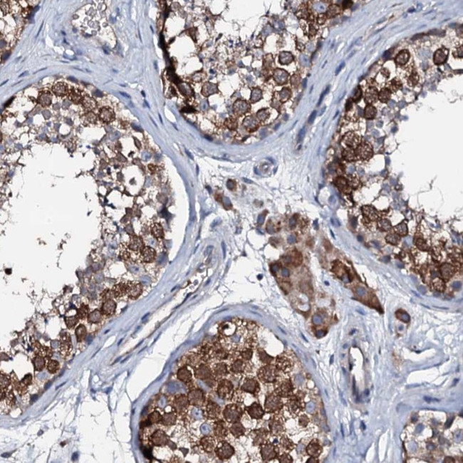 TRAFD1 Antibody in Immunohistochemistry (IHC)