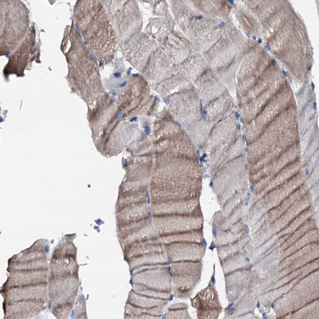 TRAFD1 Antibody in Immunohistochemistry (IHC)