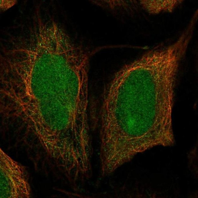 DIS3 Antibody in Immunocytochemistry (ICC/IF)