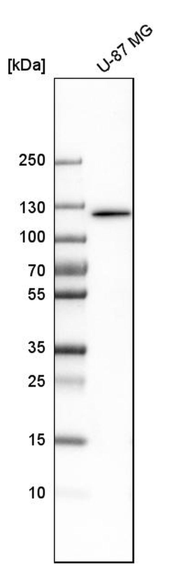 DIS3 Antibody in Western Blot (WB)