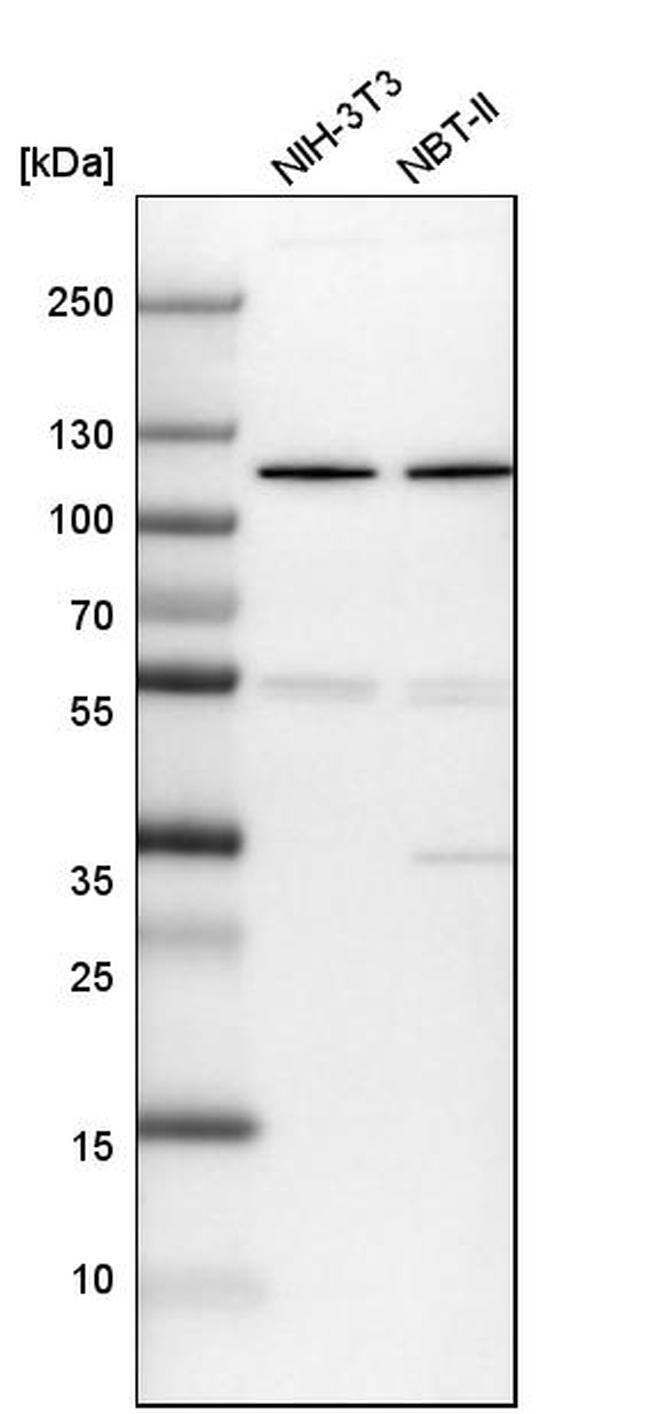 DIS3 Antibody in Western Blot (WB)