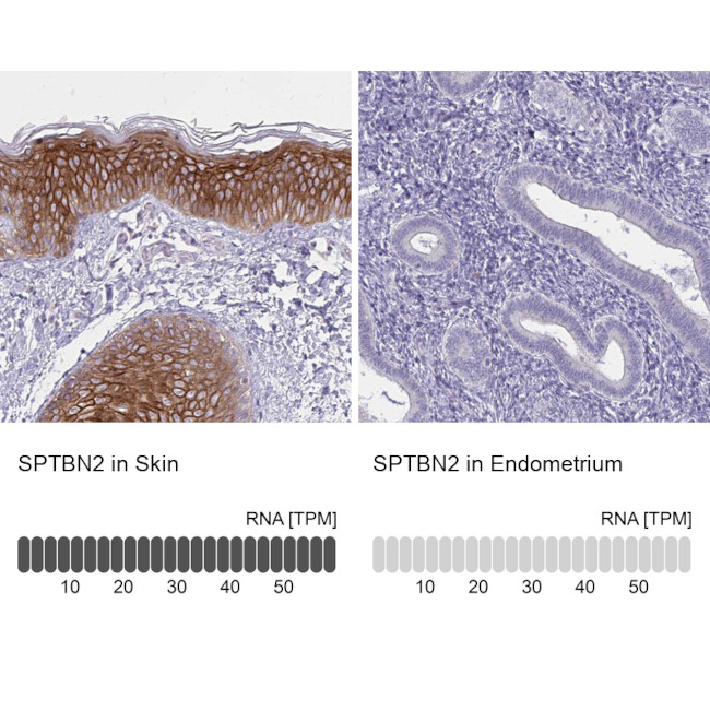 Spectrin beta-3 Antibody in Immunohistochemistry (IHC)