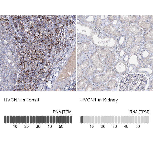 HVCN1 Antibody in Immunohistochemistry (IHC)