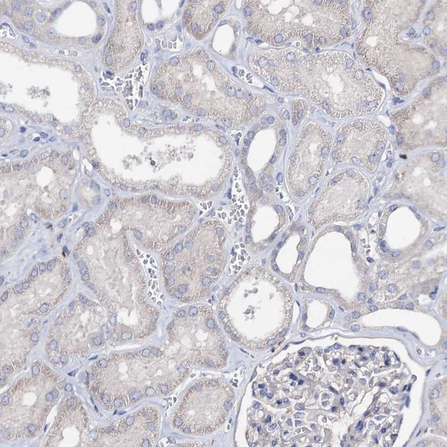 HVCN1 Antibody in Immunohistochemistry (IHC)