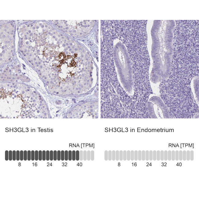 SH3GL3 Antibody in Immunohistochemistry (IHC)