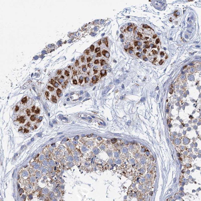 CCP110 Antibody in Immunohistochemistry (IHC)