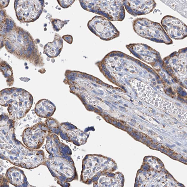 CCP110 Antibody in Immunohistochemistry (IHC)