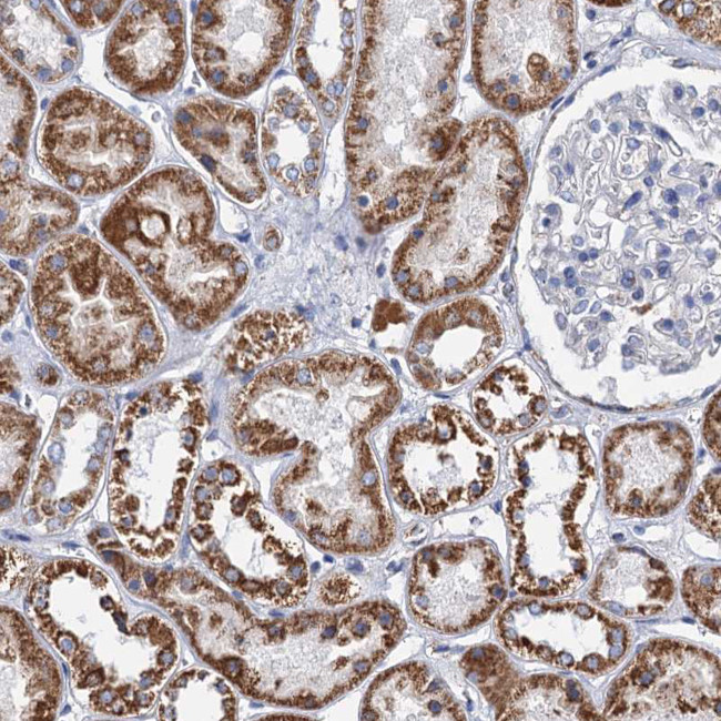 CCP110 Antibody in Immunohistochemistry (IHC)