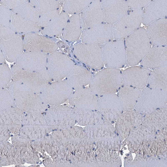 CCP110 Antibody in Immunohistochemistry (IHC)