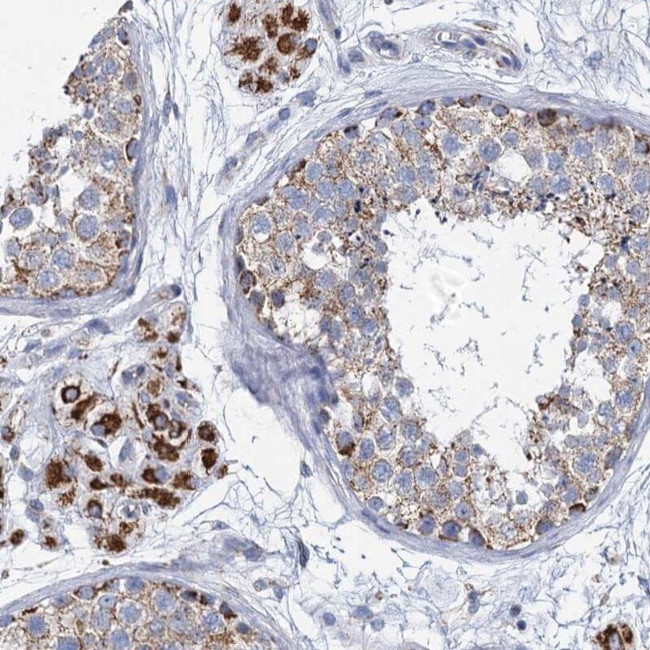 CCP110 Antibody in Immunohistochemistry (IHC)