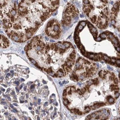 SUCLA2 Antibody in Immunohistochemistry (IHC)