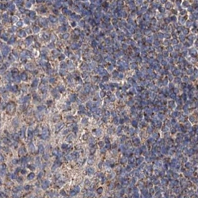 SUCLA2 Antibody in Immunohistochemistry (IHC)