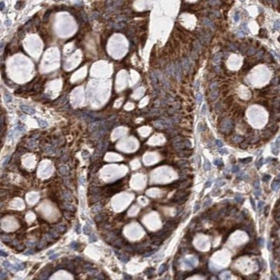 SUCLA2 Antibody in Immunohistochemistry (IHC)