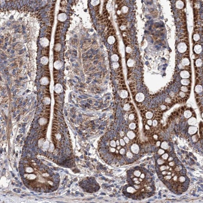 SUCLA2 Antibody in Immunohistochemistry (IHC)