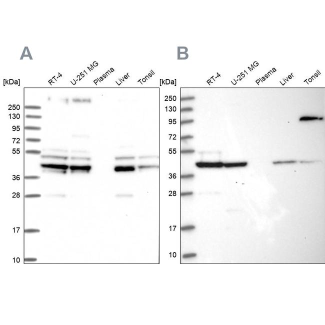 SUCLA2 Antibody in Western Blot (WB)