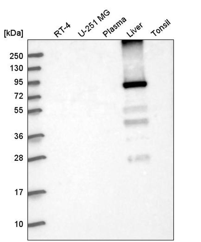 GYS2 Antibody in Western Blot (WB)