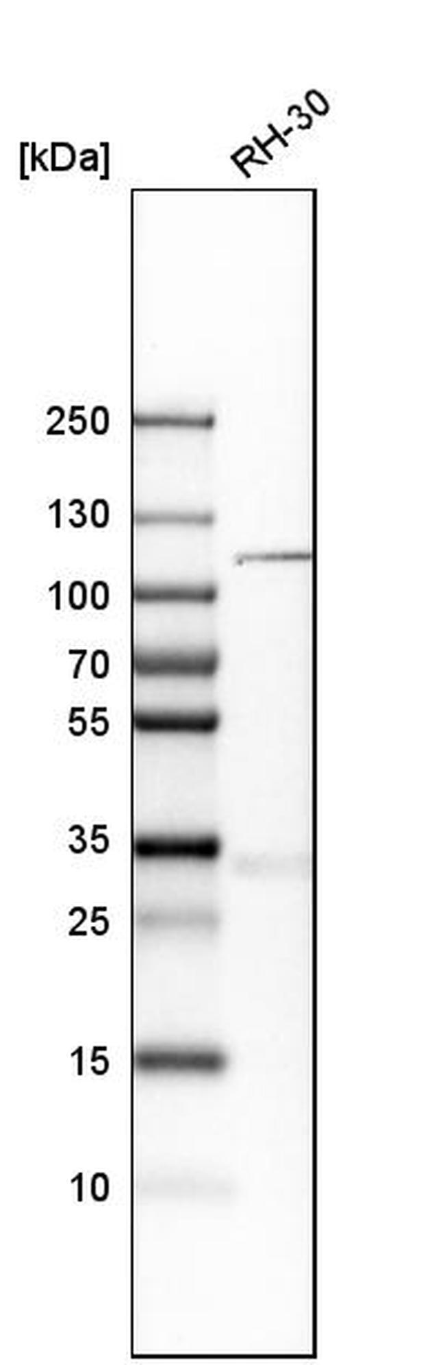 KIF18A Antibody in Western Blot (WB)