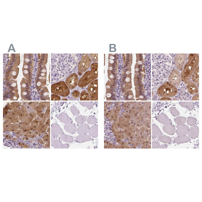 DAK Antibody in Immunohistochemistry (IHC)