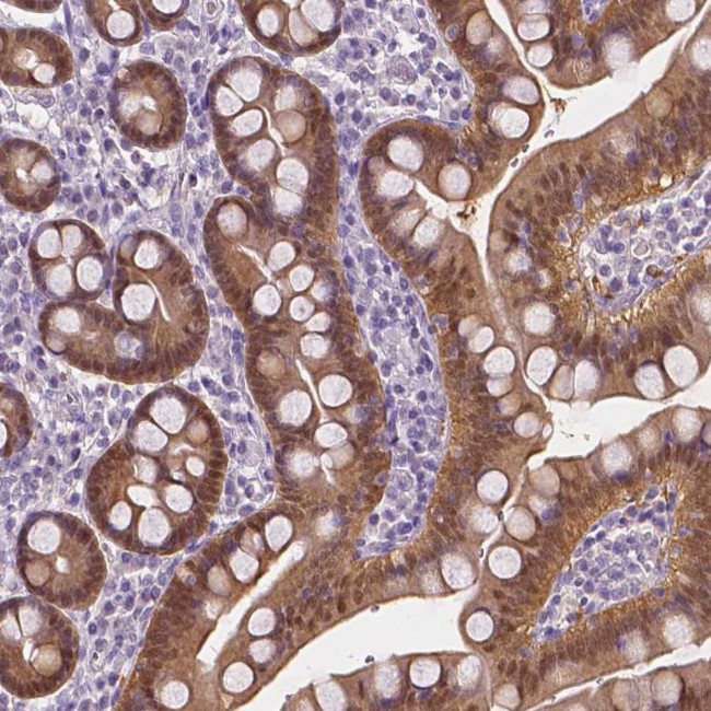 DAK Antibody in Immunohistochemistry (IHC)