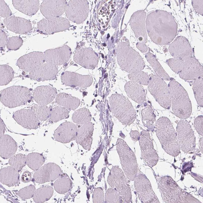 DAK Antibody in Immunohistochemistry (IHC)