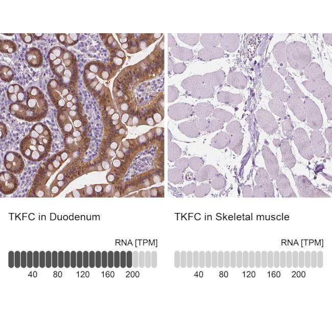 DAK Antibody