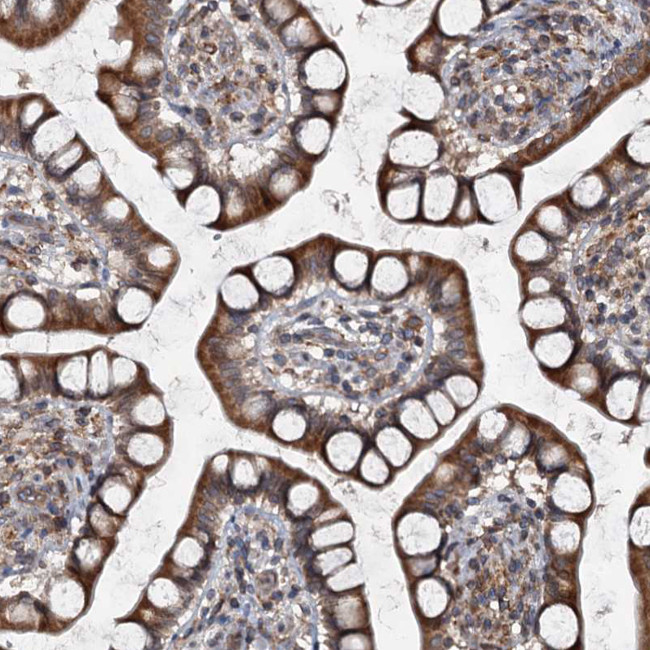 TAPBPL Antibody in Immunohistochemistry (IHC)