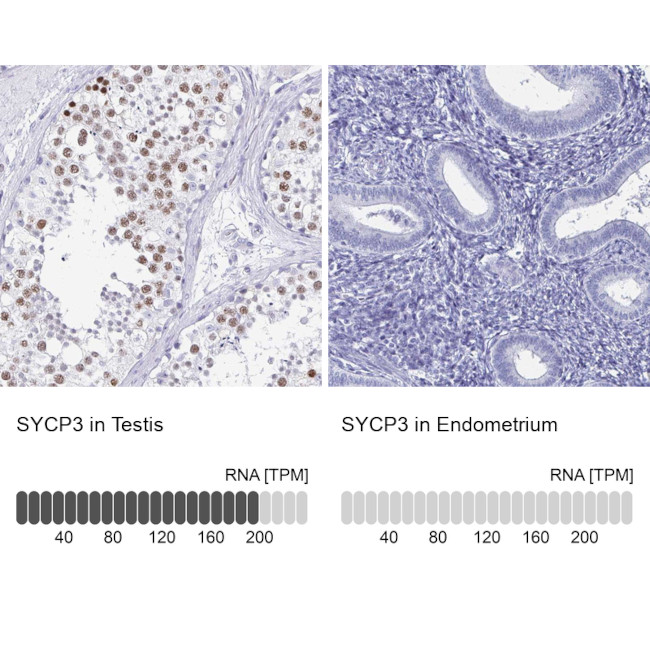 SCP3 Antibody in Immunohistochemistry (IHC)