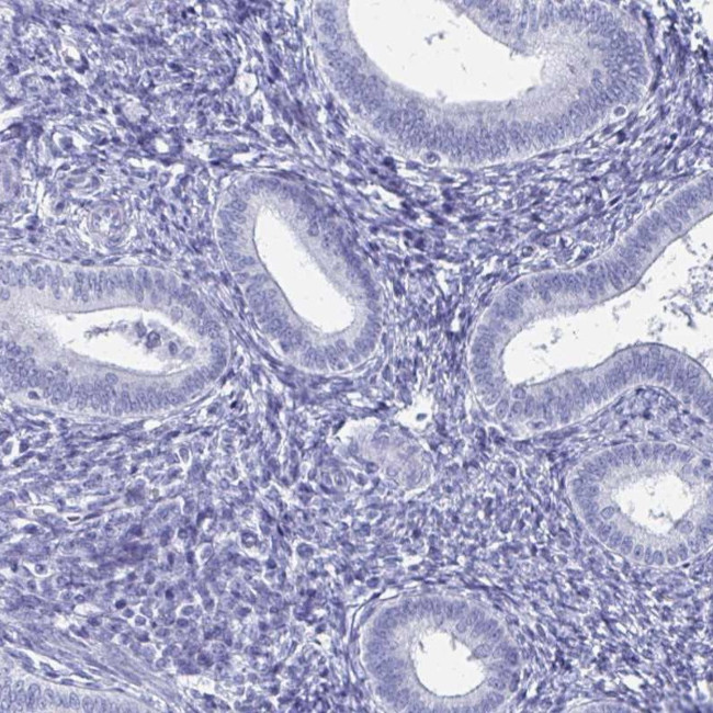 SCP3 Antibody in Immunohistochemistry (IHC)