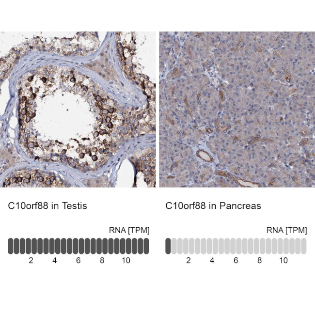 C10orf88 Antibody in Immunohistochemistry (IHC)